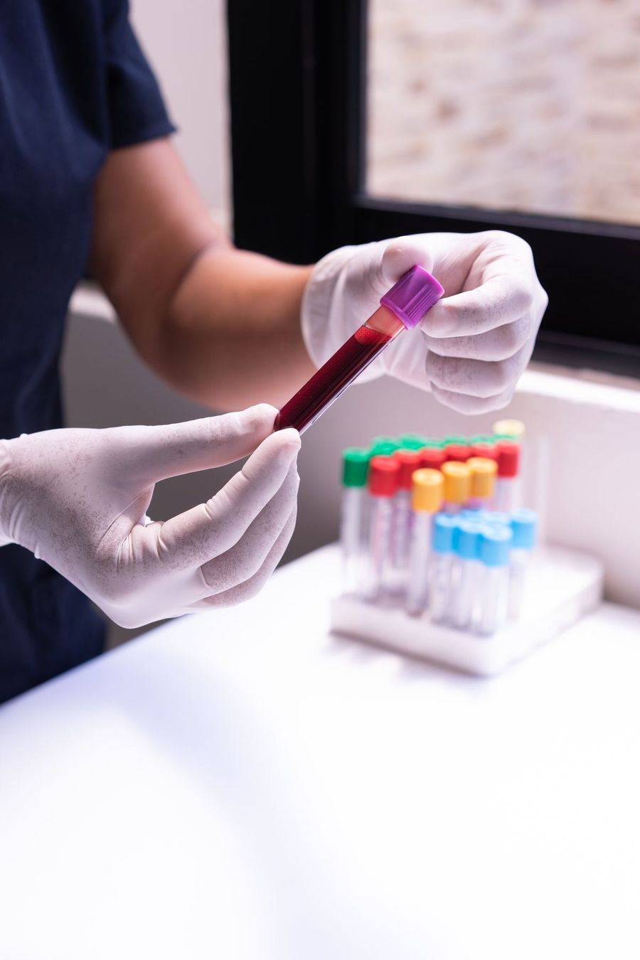 A healthcare worker checking a blood sample